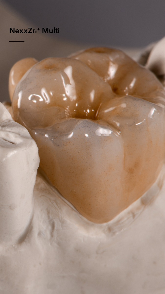 NexxZr + Multi -20 mm Z-95