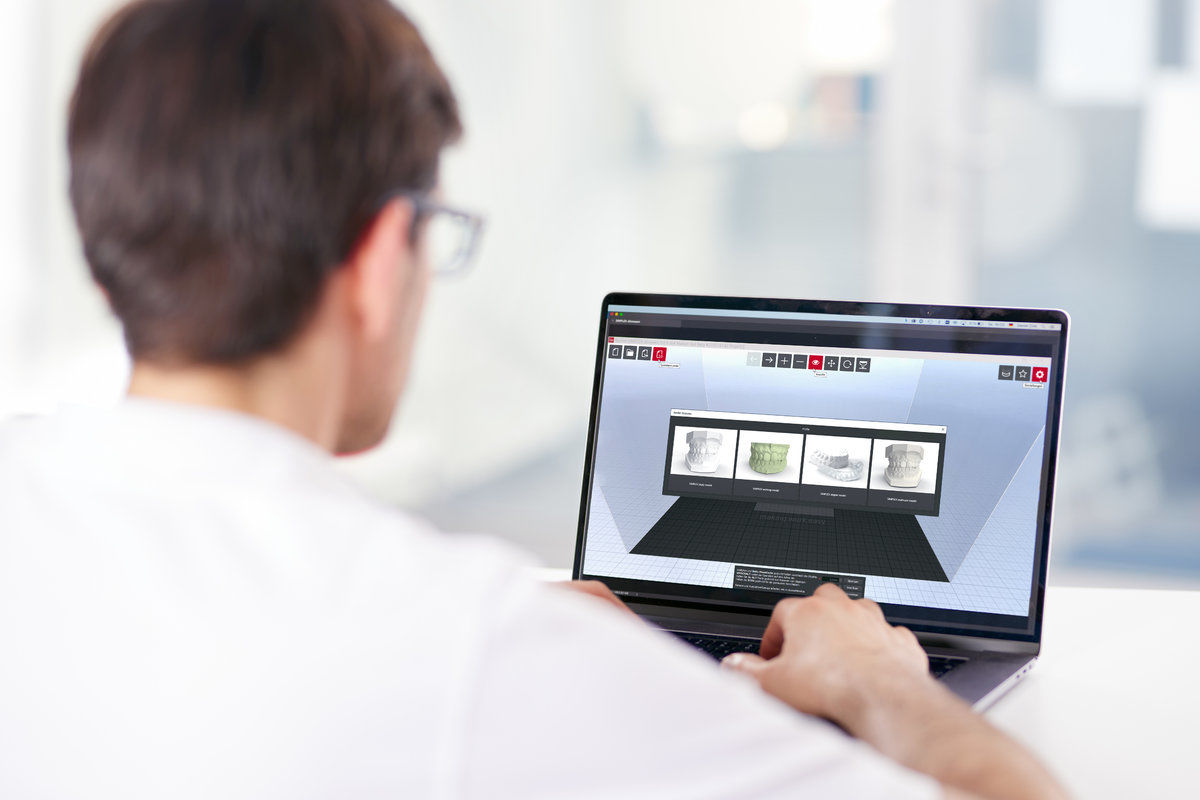 SIMPLEX 3D filament printer