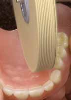 Linen buff siliconised, Renfert