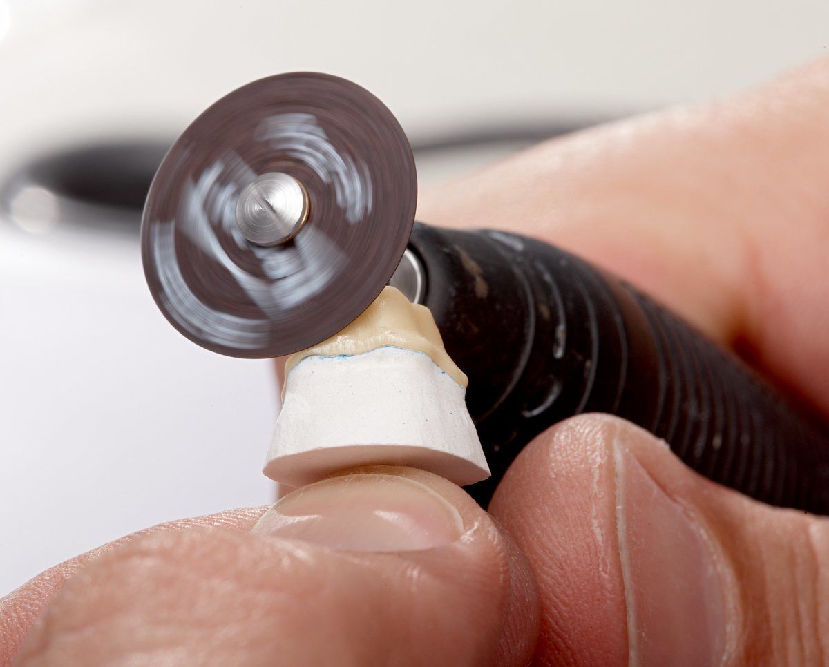 Dynex Brillant Separating discs