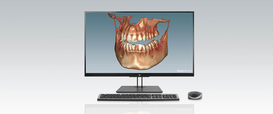 Ceramill Dicom Viewer