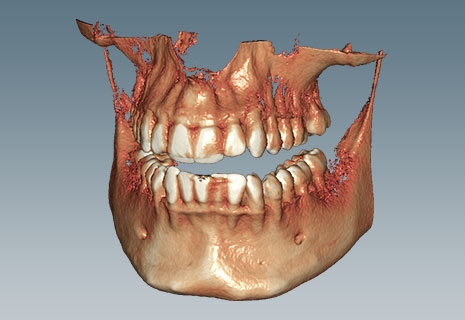Ceramill Dicom Viewer