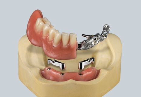 Ceramill M-Bars