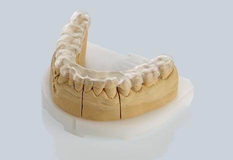 Ceramill M-Splint