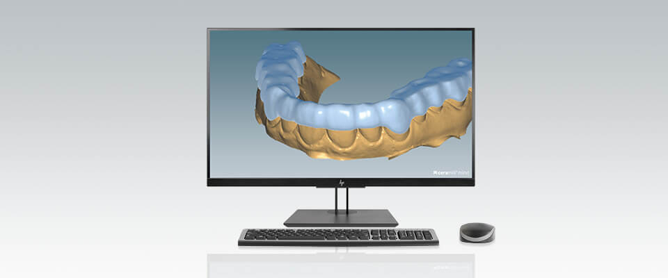 Ceramill M-Splint