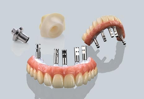 Ceramill M-Plant