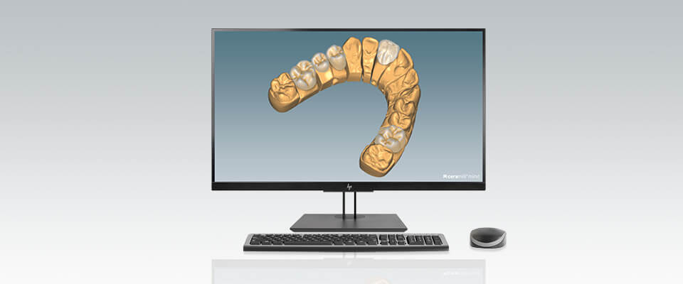 Ceramill Midforms 2.0 by Knut Miller