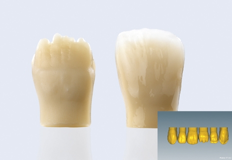 Ceramill Mindforms Cut-back Extension