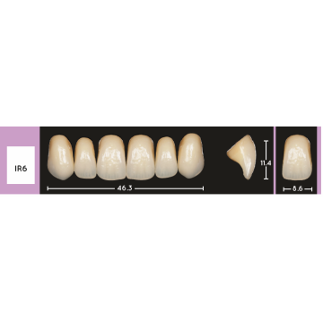 Enigmalife Anterier - IR6 - Upper