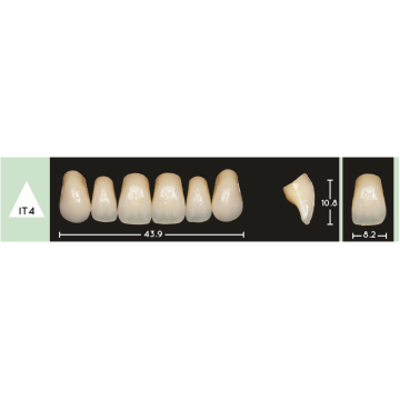 Enigmalife Anterier - IT4 - Upper