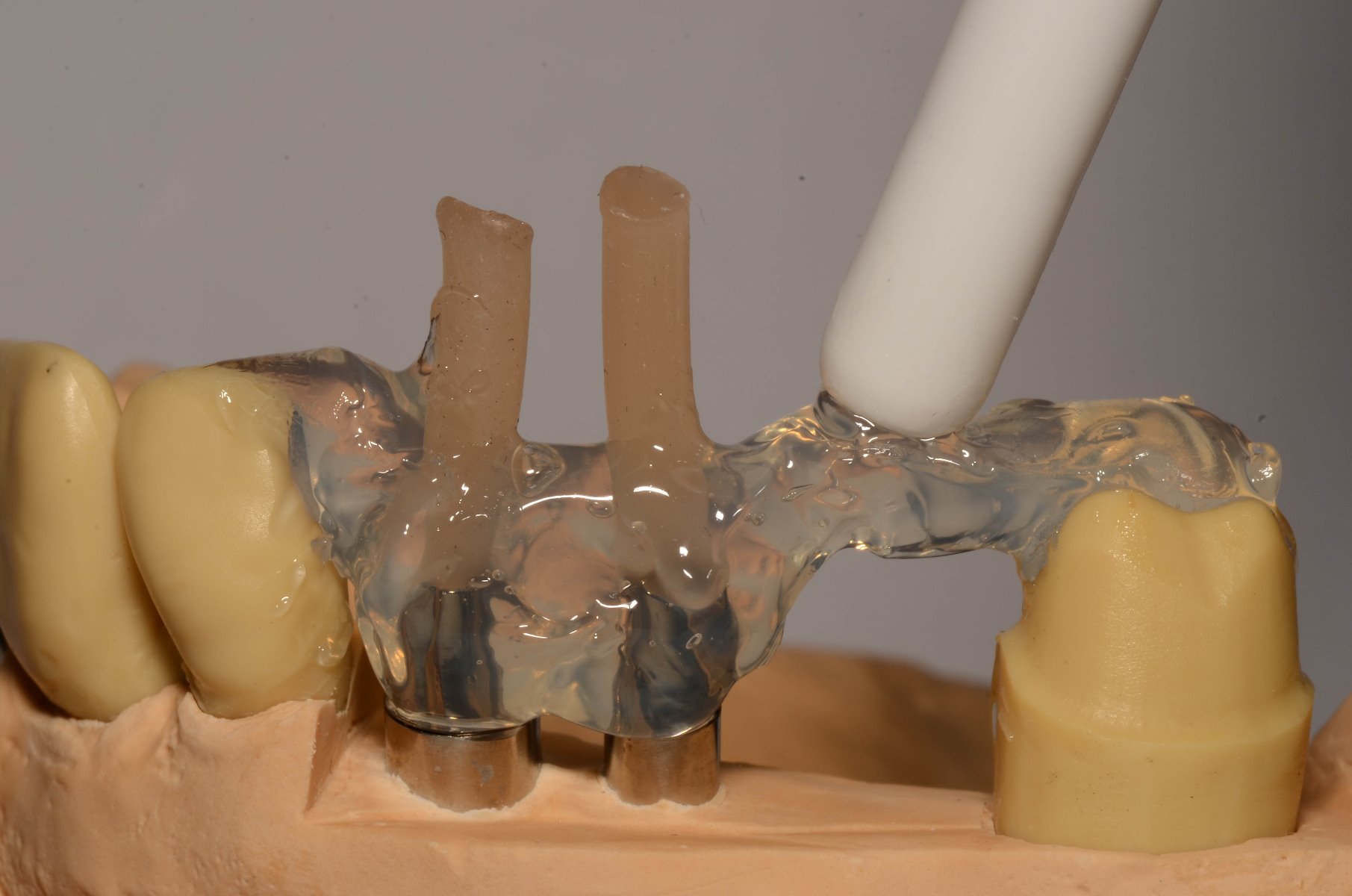 LUKAClear modeling gel transparent, Tube 20 gr incl. cannula