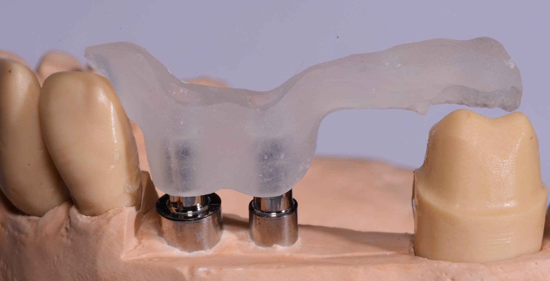 LUKAClear modeling gel transparent, Tube 20 gr incl. cannula