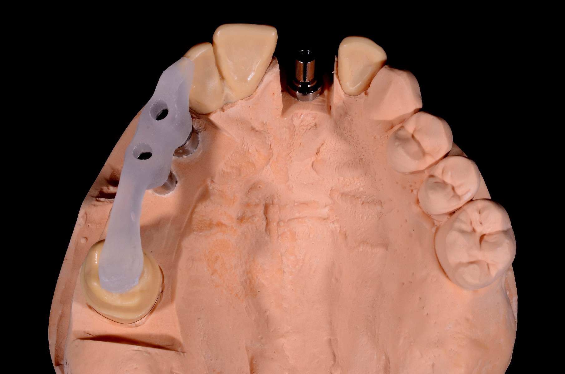 LUKAClear modeling gel transparent, Tube 20 gr incl. cannula