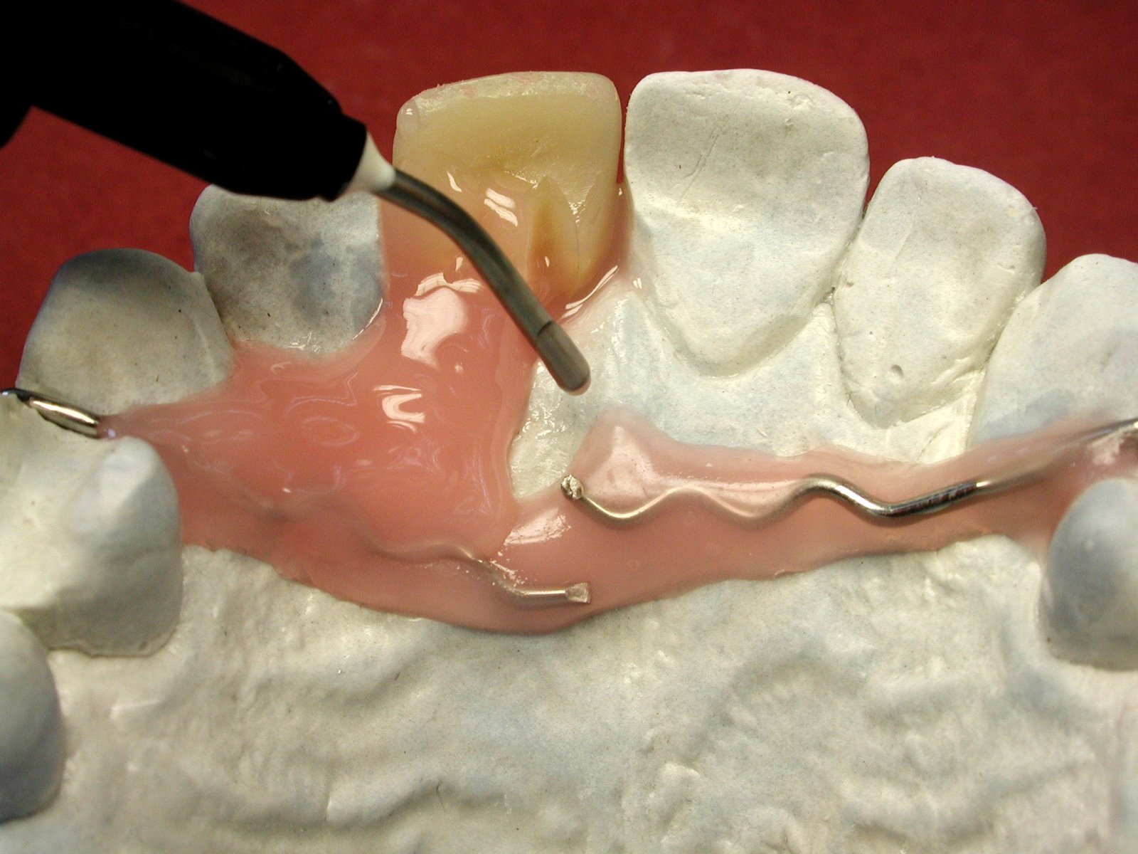 LUKAFix-Kit, color pink (3x3gr. Syringe, incl. tips)