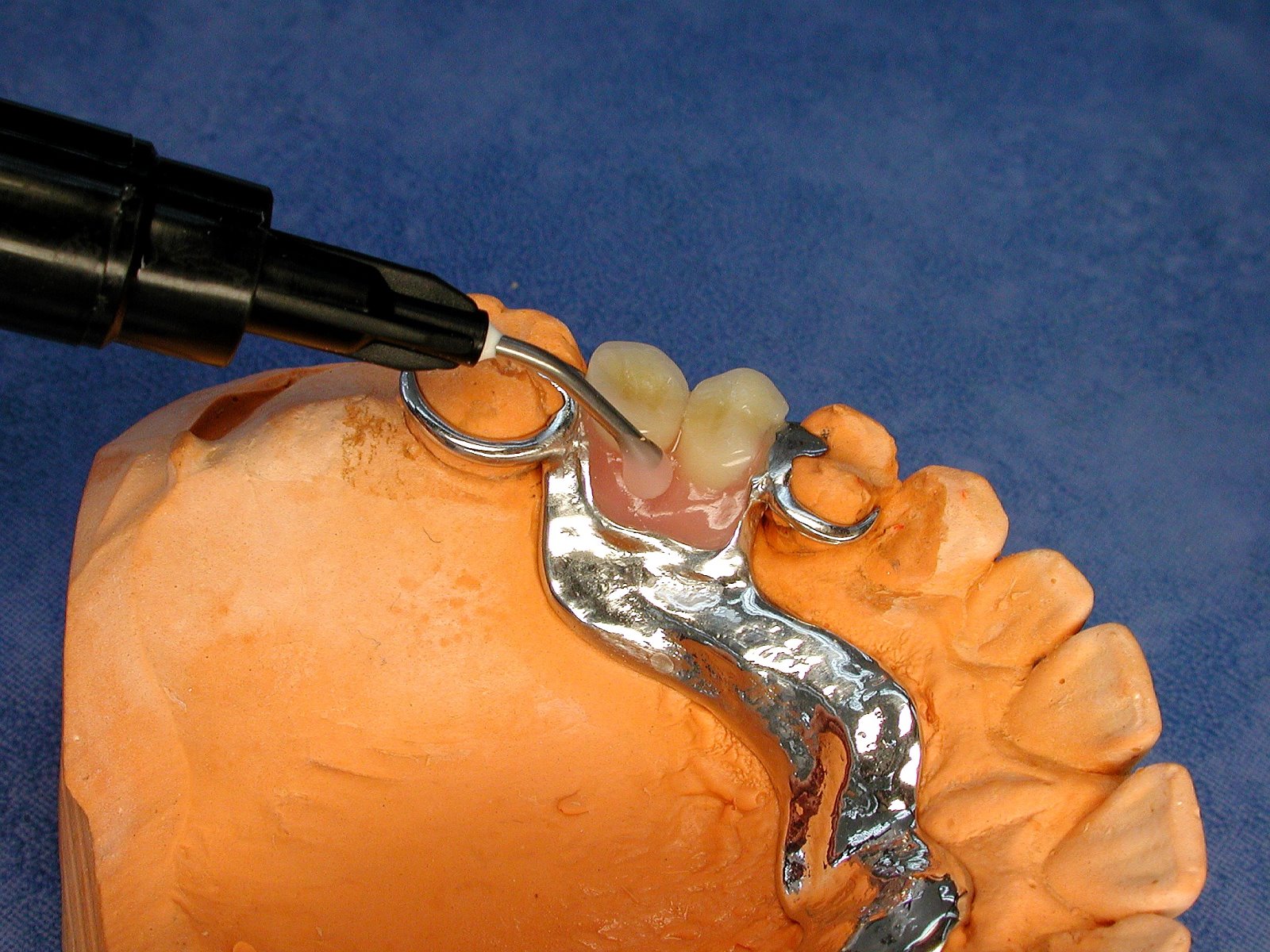 LUKAFix-Kit, color pink (3x3gr. Syringe, incl. tips)