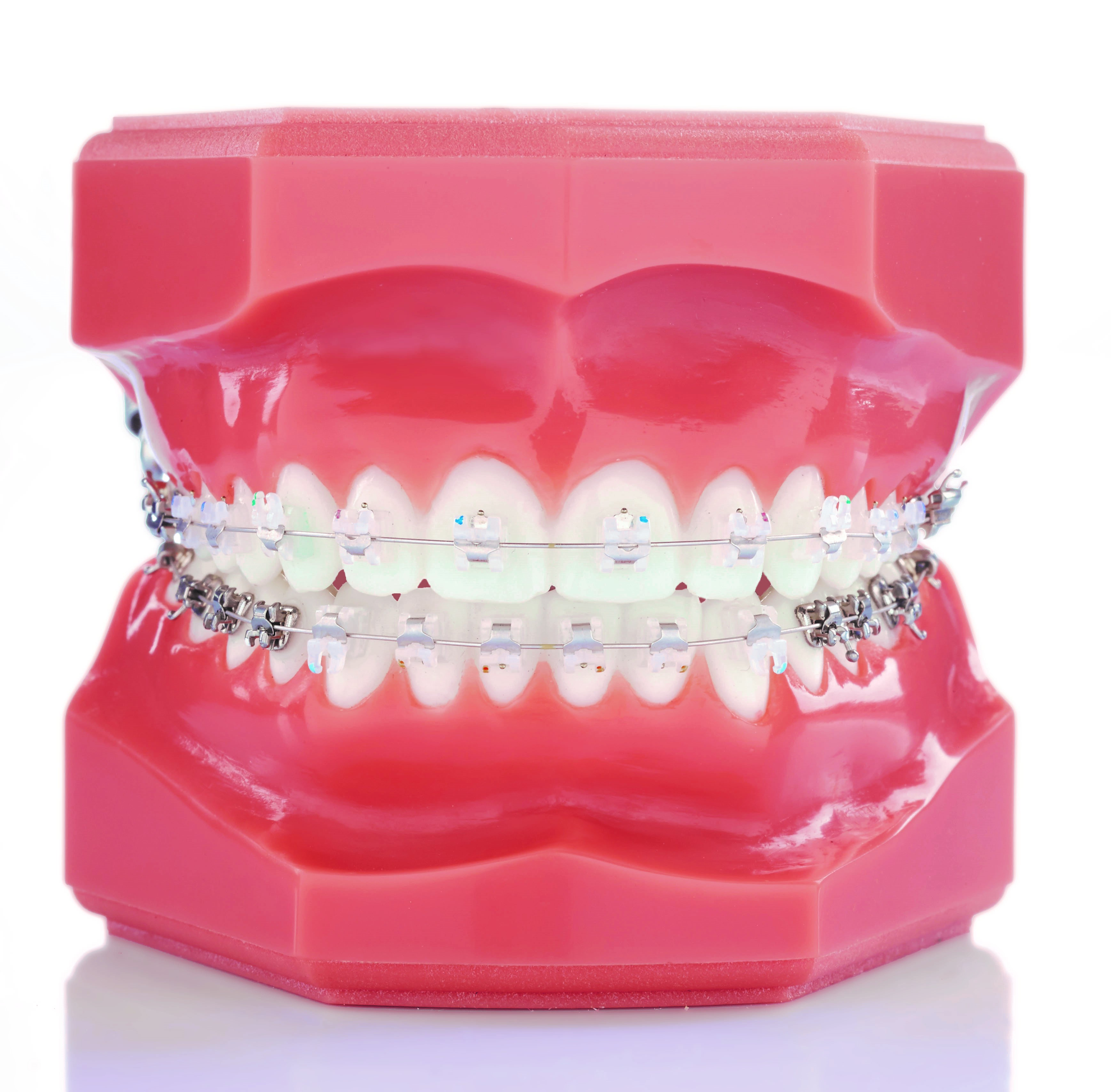 Experience Ceramic KIT 022