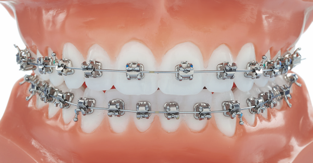 Experience Metal 018