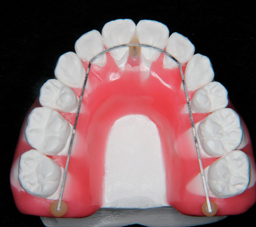 GC KOMMONBASE HV PINK