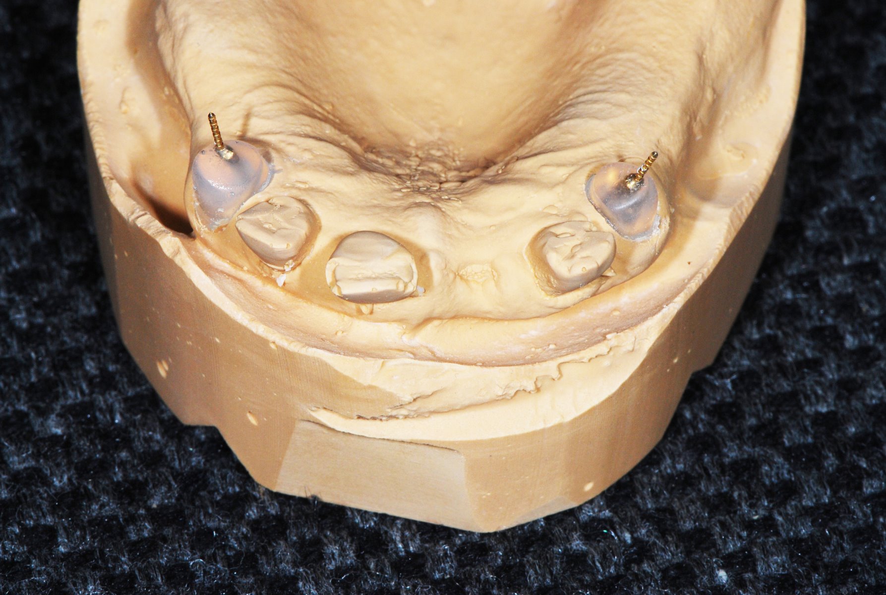 LUKAClear modeling gel transparent, Tube 20 gr incl. cannula