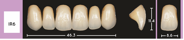 Enigmalife Anterier - IR6 - Upper