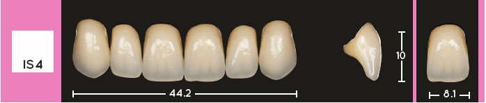 Enigmalife Anterier - IS4 - Upper