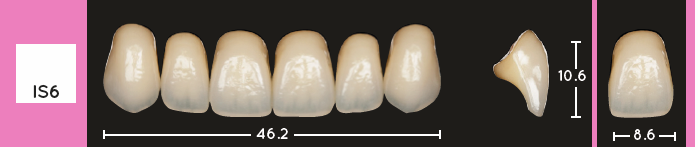 Enigmalife Anterier - IS6 - Upper