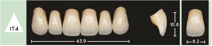 Enigmalife Anterier - IT4 - Upper
