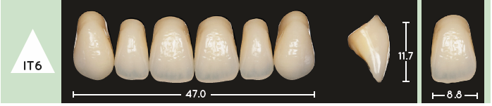 Enigmalife Anterier - IT6 - Upper
