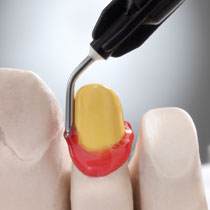 LUKAPattern modelling gel 3 x 3 gr Syringe, incl. tips