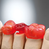 LUKAPattern modelling gel 3 x 3 gr Syringe, incl. tips