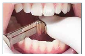 6mm Single-sided Diamond Blades - MiniStripper