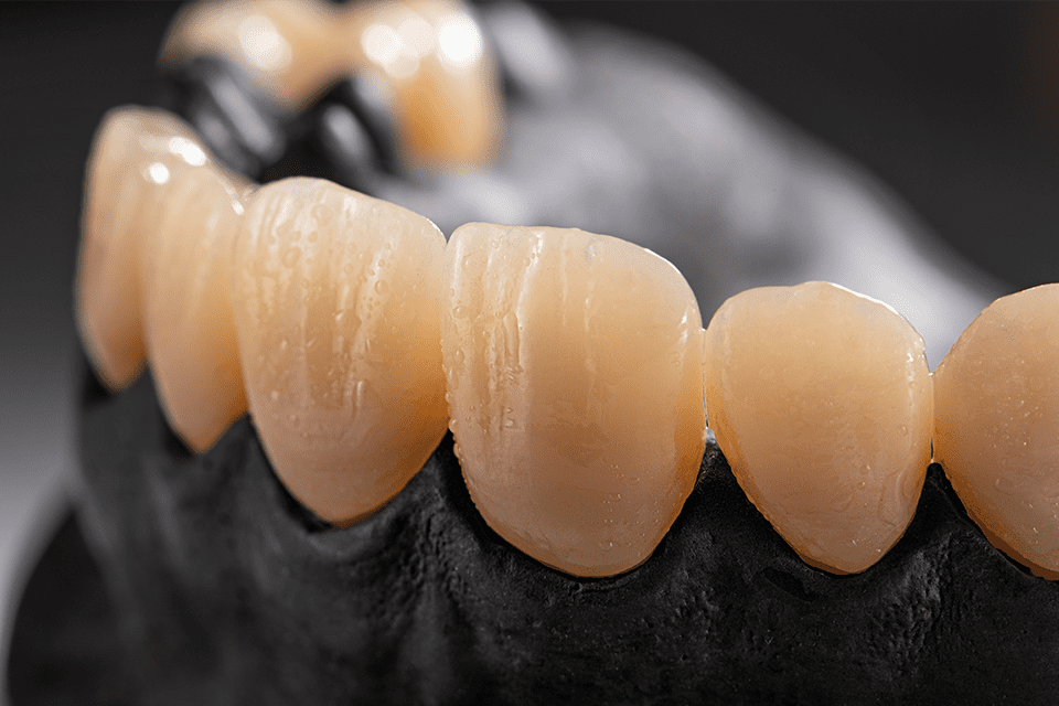 NexxZr + Multi -16 mm W-98