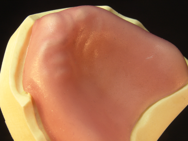 Primobase Lysherdende baseplate 1,2 mm   