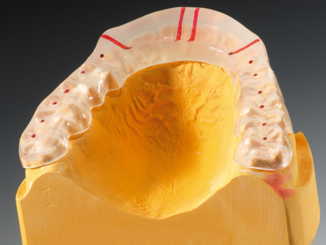 PrimoSplint Boks á 12 stenger