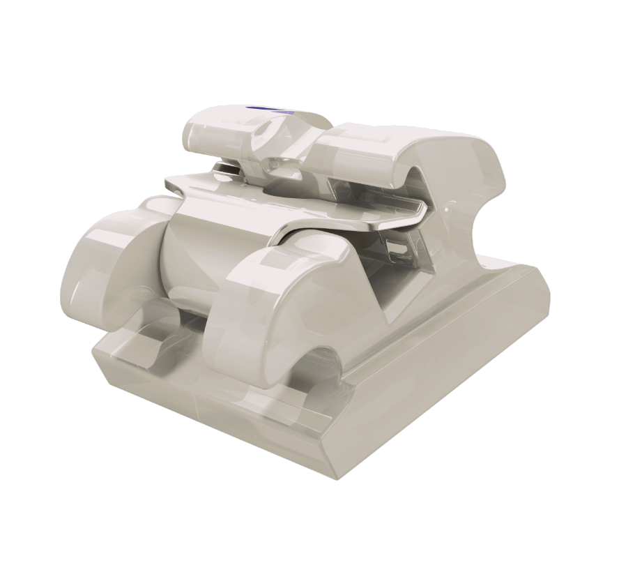 Experience Ceramic KIT 022