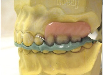 SmoothStar Bite - Mixing Tip Green