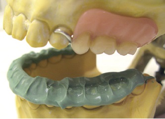 SmoothStar Bite - Mixing Tip Green