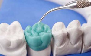 Sculpting tips til Waxlectric